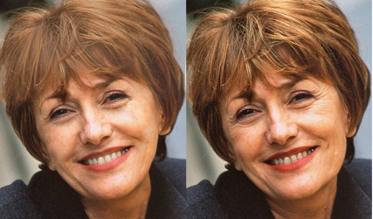 Foto des Gesichts vor und nach der Konturierung